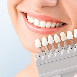 Tẩy Trắng Răng Plasma - Bí Quyết Cho Nụ Cười Rạng Rỡ