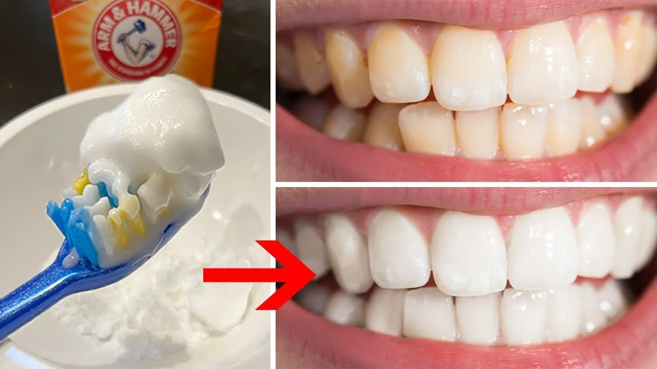 Tẩy Trắng Răng Với Baking Soda - Bí Quyết Nụ Cười Rạng Rỡ Tại Nhà