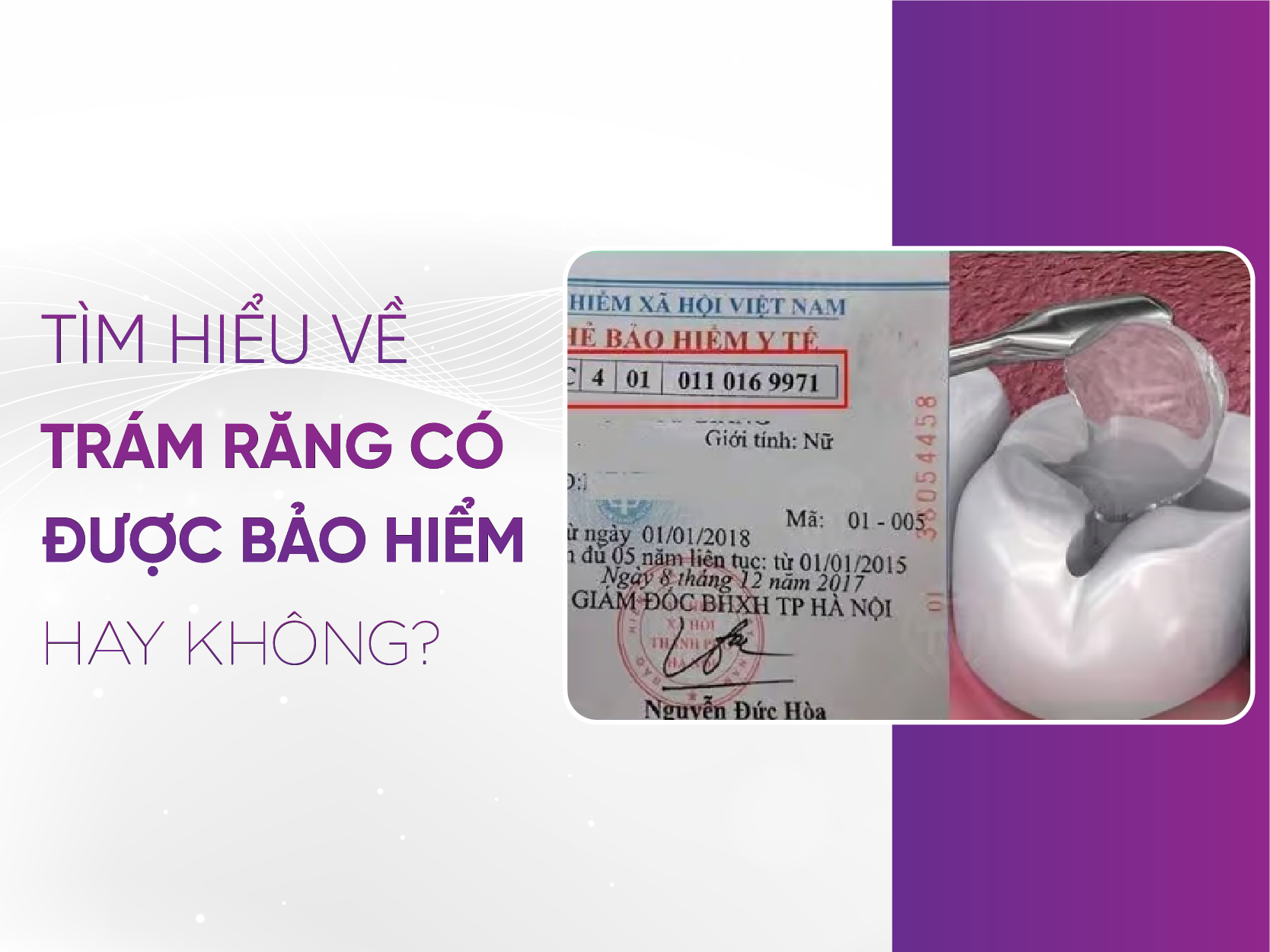 Trám Răng Có Được Bảo Hiểm Không -Quyền Lợi Và Chi Phí 2025