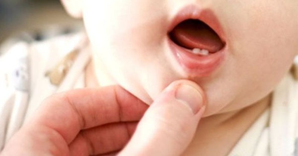 Trẻ mọc răng biếng ăn: Nguyên nhân và cách khắc phục hiệu quả