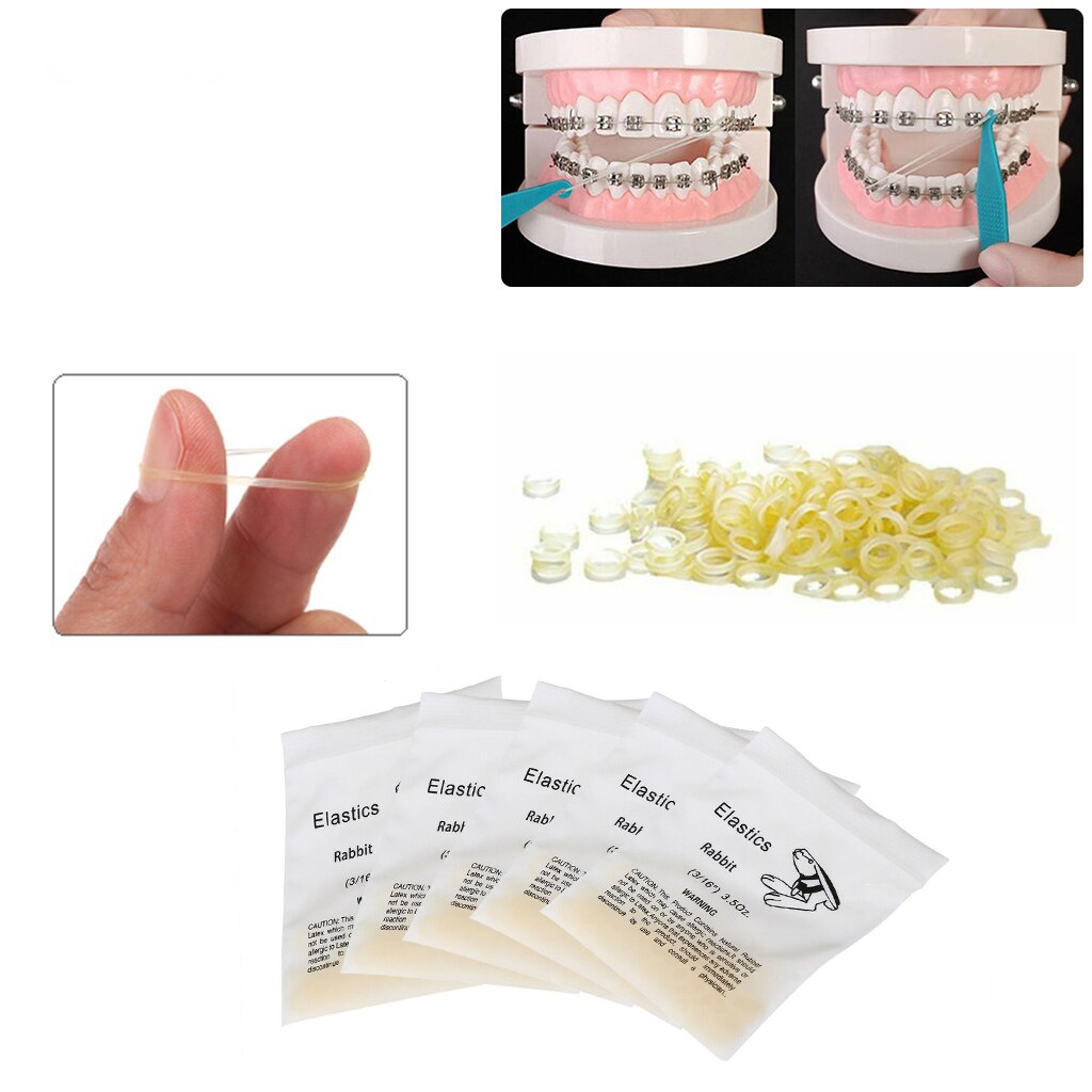 Chun chỉnh nha - Kiến tạo nụ cười hoàn hảo từ nền tảng vững chắc