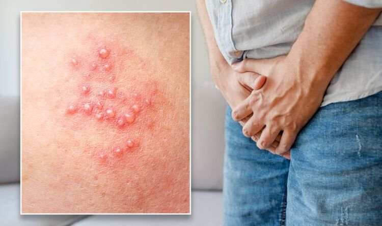 HPV lây qua đường nào - Chìa khóa hiểu rõ và bảo vệ bản thân