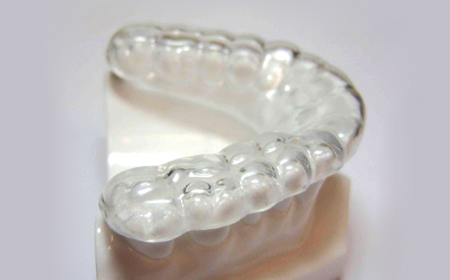 Nghiến răng do đâu? Nguyên nhân và cách khắc phục hiệu quả