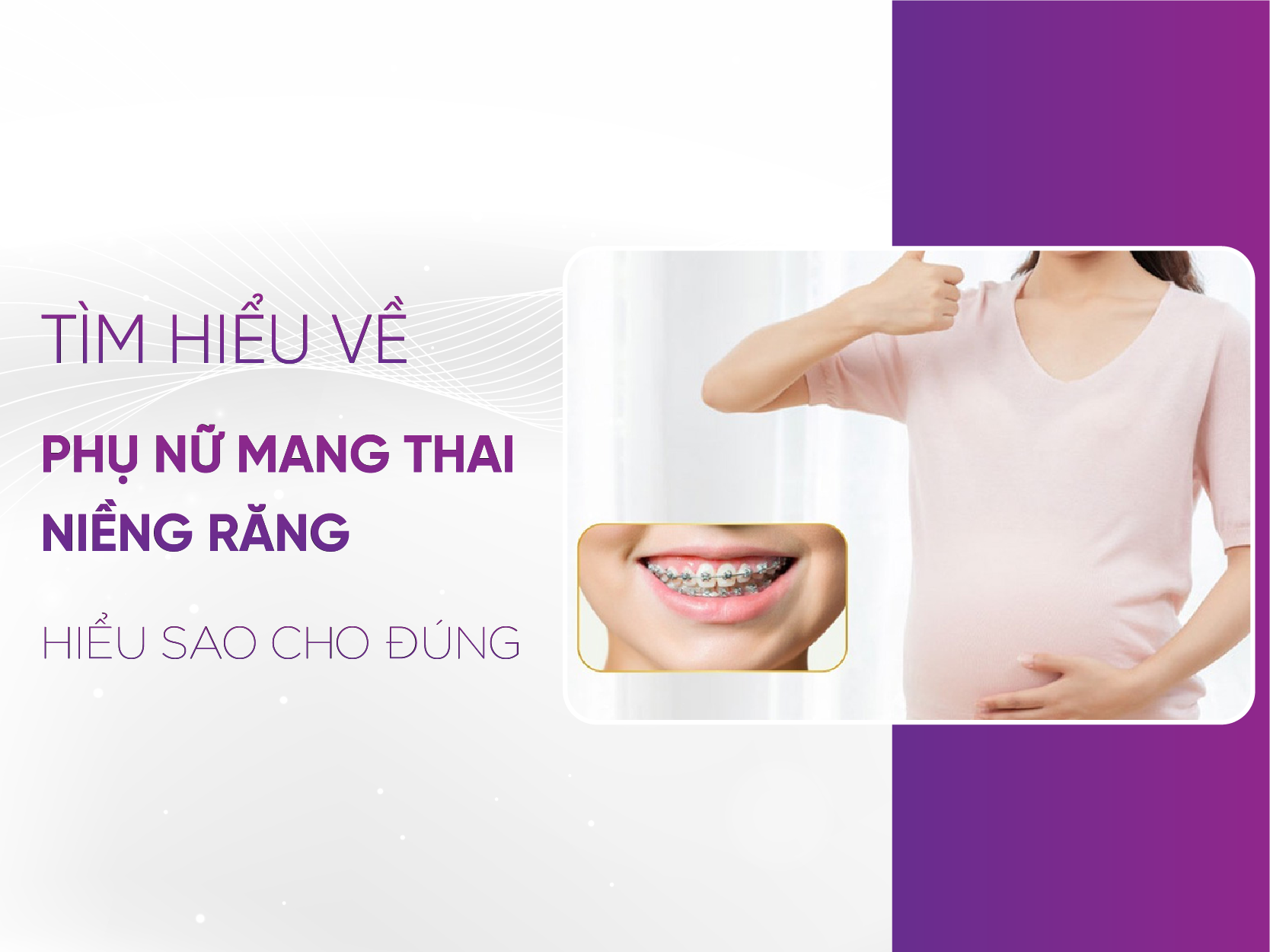 Phụ Nữ Mang Thai Niềng Răng - Cân Nhắc Toàn Diện Cho Mẹ Và Bé An Toàn