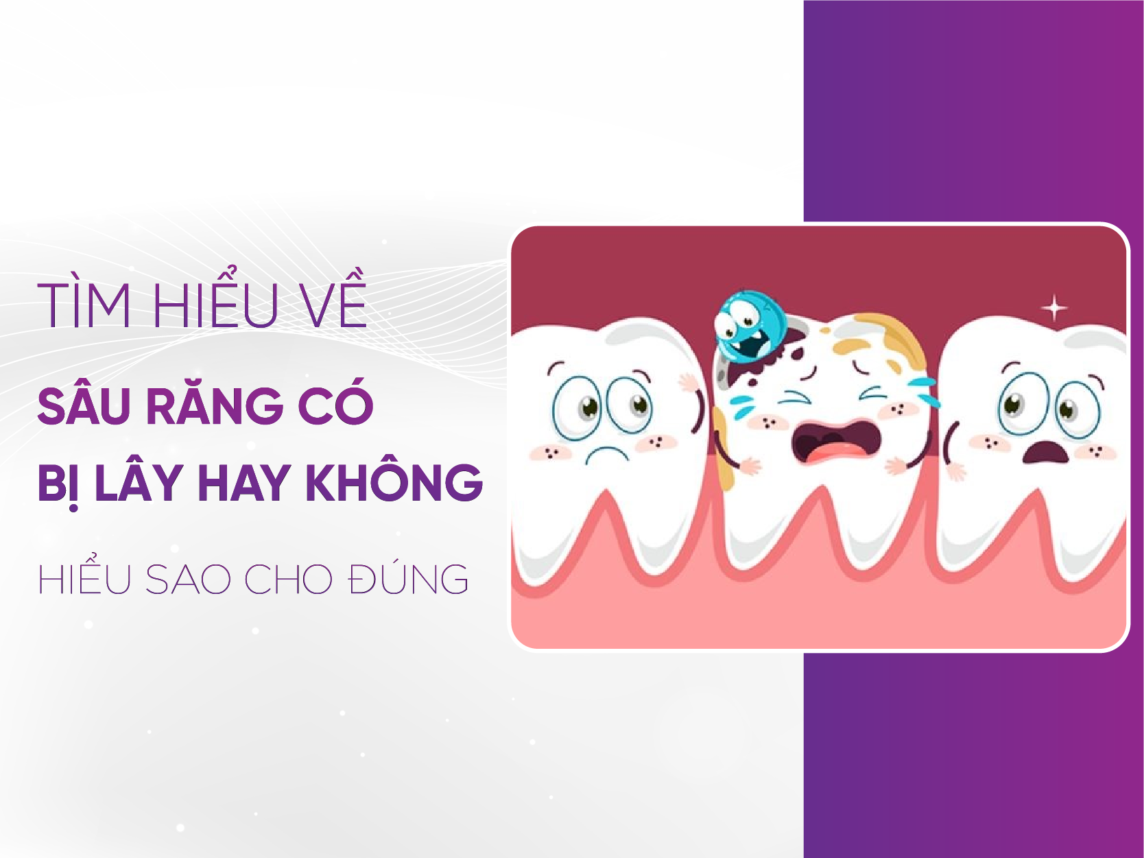 Sâu Răng Có Bị Lây Không? Sự Thật Bạn Cần Biết