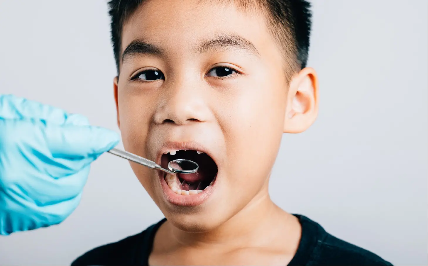 Sâu răng có bị lây không? Sự thật bạn cần biết để bảo vệ răng miệng Sâu Răng Có Bị Lây Không? Sự Thật Bạn Cần Biết Để Bảo Vệ Răng Miệng