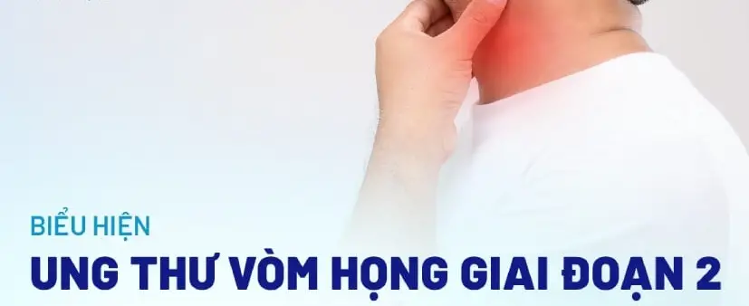 Ung thư vòm họng là gì