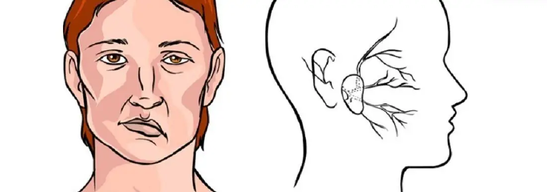 Lệch hàm có ảnh hưởng gì không - Hậu quả và Giải pháp Toàn diện