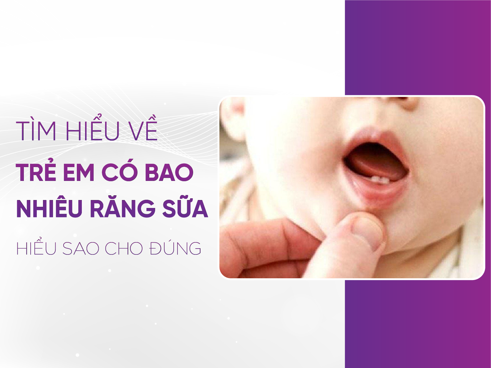 Trẻ Em Có Bao Nhiêu Răng Sữa? Từ 6 Tháng Đến 3 Tuổi