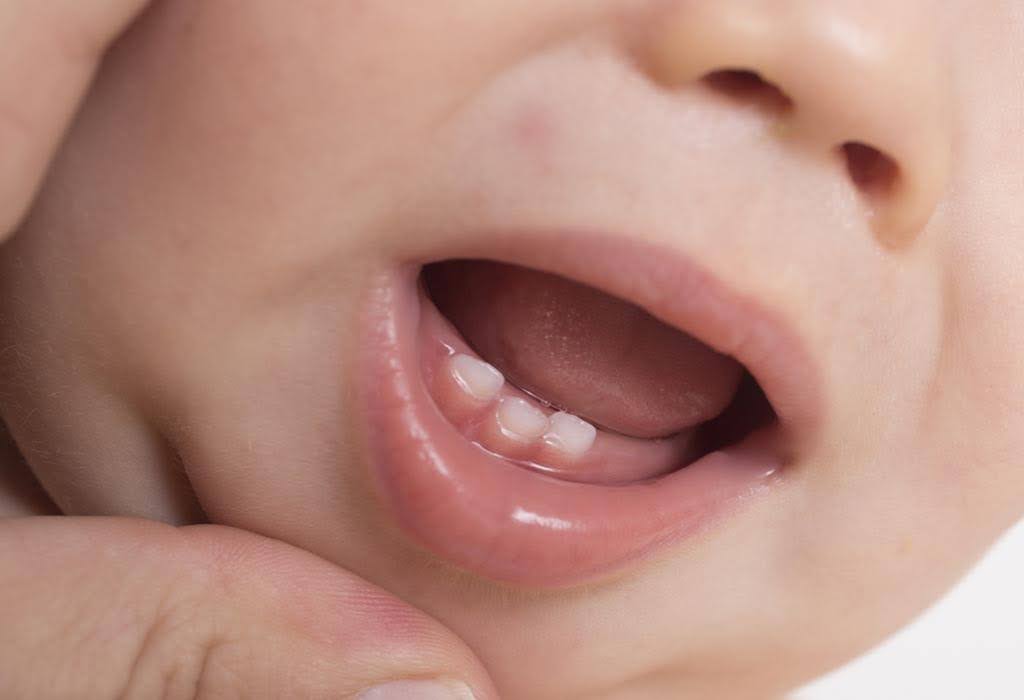 Trẻ mọc răng có những biểu hiện gì? Dấu hiệu nhận biết và cách chăm sóc trẻ hiệu quả
