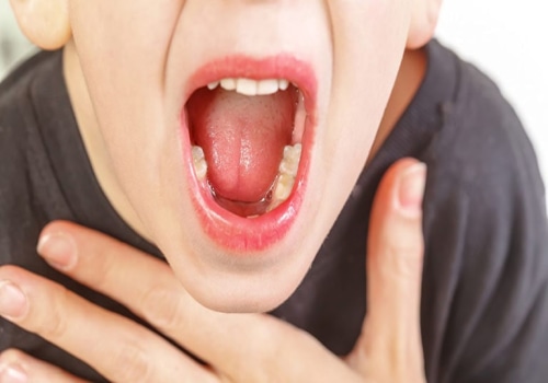 Viêm gai lưỡi – Giải mã triệu chứng và bí quyết chữa trị tối ưu