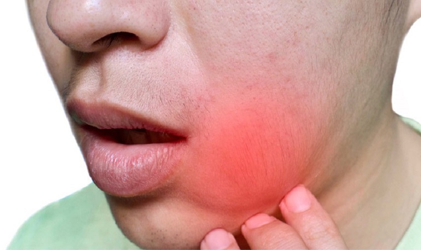 Cách xử trí khi bị sót chân răng khôn: Có phải lúc nào cũng cần lấy ra?