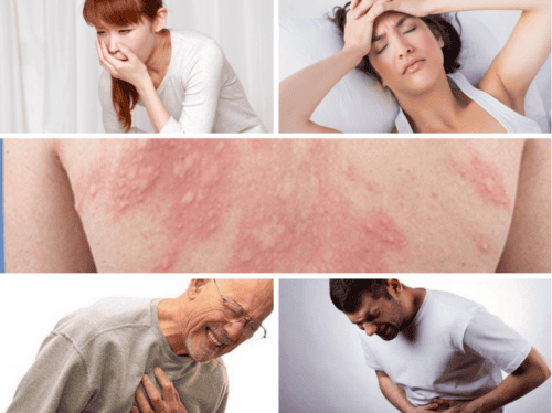 Sốc phản vệ khi nhổ răng và cách ứng phó Nguyên Nhân Nào Có Thể Gây Sốc Phản Vệ Khi Nhổ Răng?