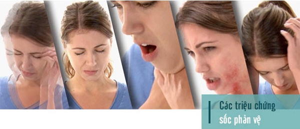 Sốc phản vệ khi nhổ răng và cách ứng phó Sốc Phản Vệ Là Gì Và Cơ Chế Gây Ra Như Thế Nào?