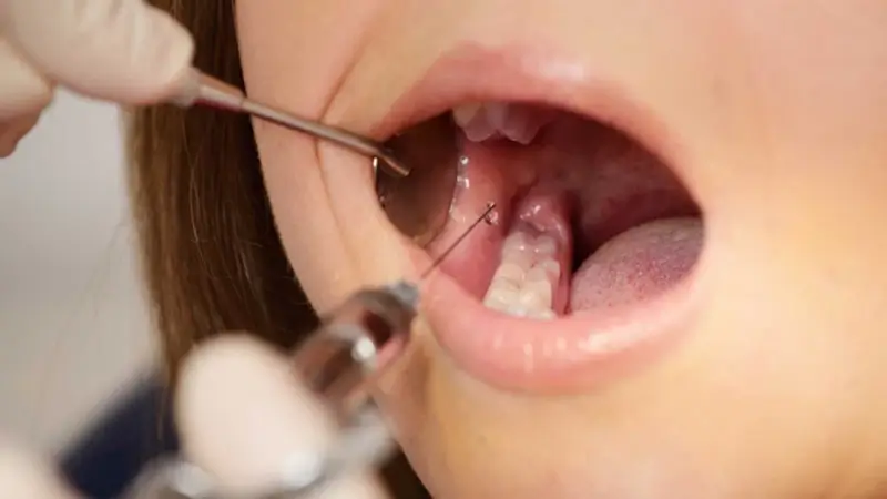 Những lưu ý quan trọng cần biết khi chưa hết thuốc tê?