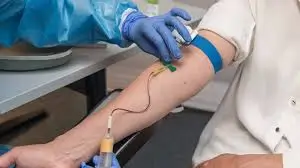 Khi nào cần xét nghiệm máu nhổ răng khôn? Những Trường Hợp Nào Bắt Buộc Phải Xét Nghiệm Máu Khi Nhổ Răng Khôn?