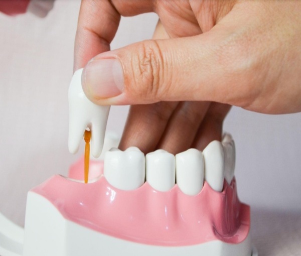 Nhổ răng cấm không trồng lại có sao không? Sau Khi Nhổ Răng Cấm, Bao Lâu Thì Những Hậu Quả Này Xảy Ra?