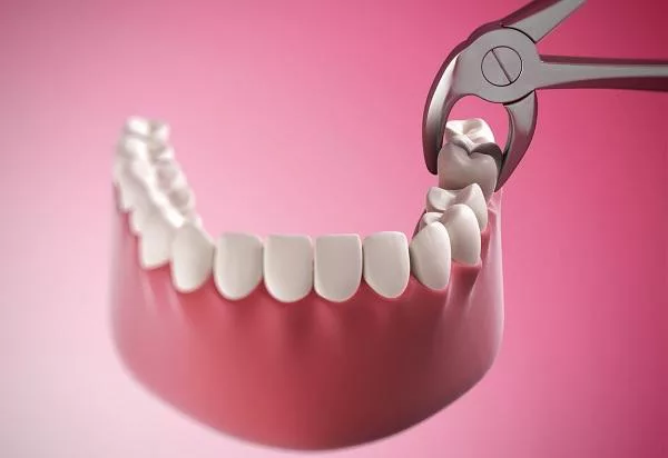 Răng cấm là răng gì? Những Rủi Ro Và Bất Lợi Khi Nhổ Răng Vào Buổi Chiều/Tối?