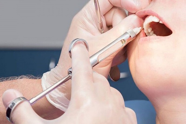 Quy Trình Nhổ Răng An Toàn Cho Người Dị Ứng