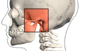 Triệu Chứng Đi Kèm Há Miệng Đau Hàm Thường Gặp Là Gì?
