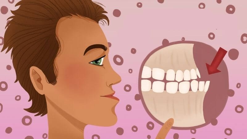 Di Truyền Có Phải Là Nguyên Nhân Lệch Khớp Cắn Hàng Đầu Không?